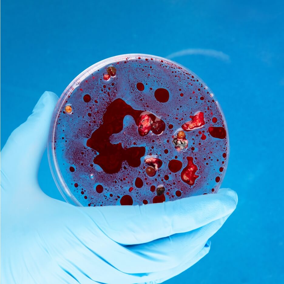 Σπάνιες Παθήσεις