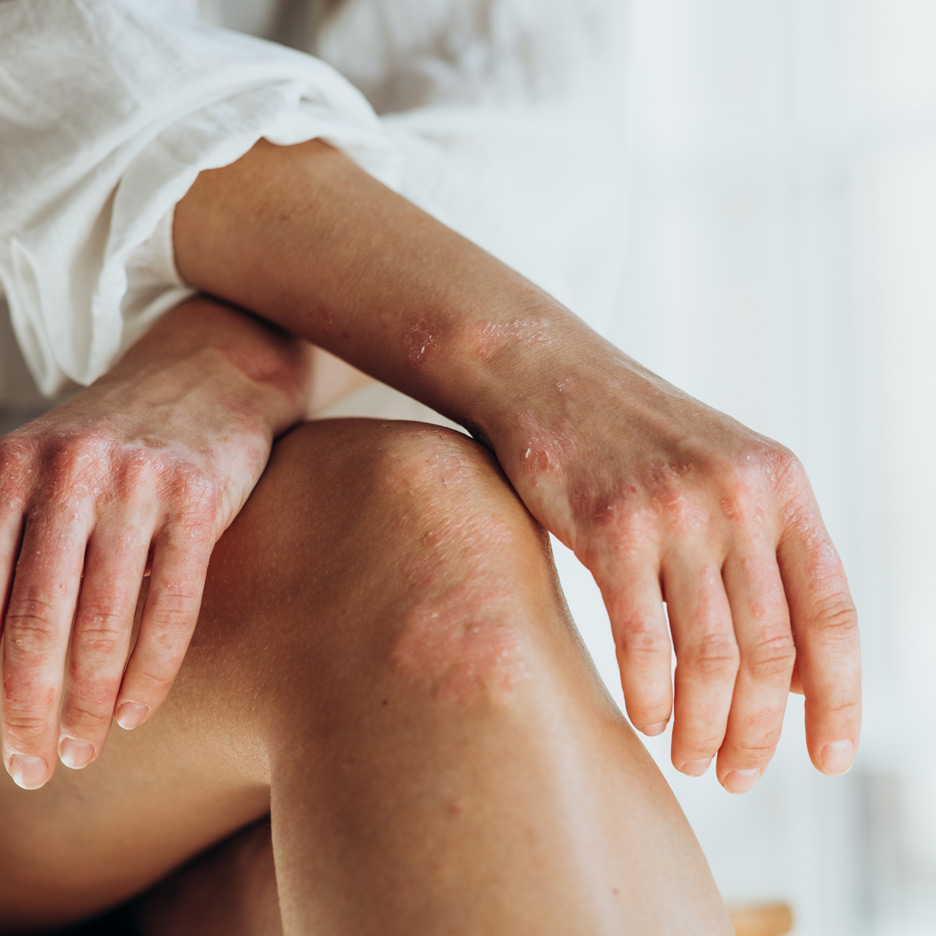 Δερματολογία / Ρευματολογία